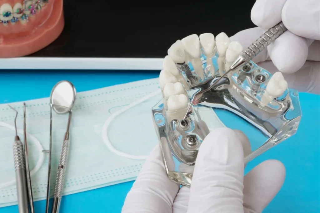 prothese adjointe numerique fabrication precision prothese adjointe numerique fabrication precision Implantologie label-dent