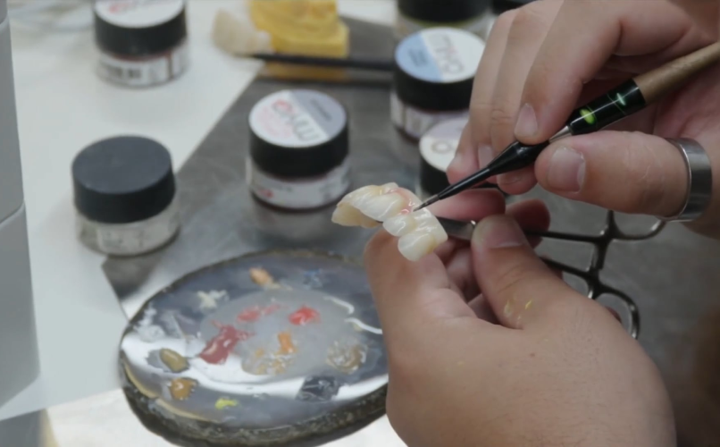 prothese conjointe fabrication cad cam "Formation céramique miyo" David Cabeza x Sophie Dallem label-dent