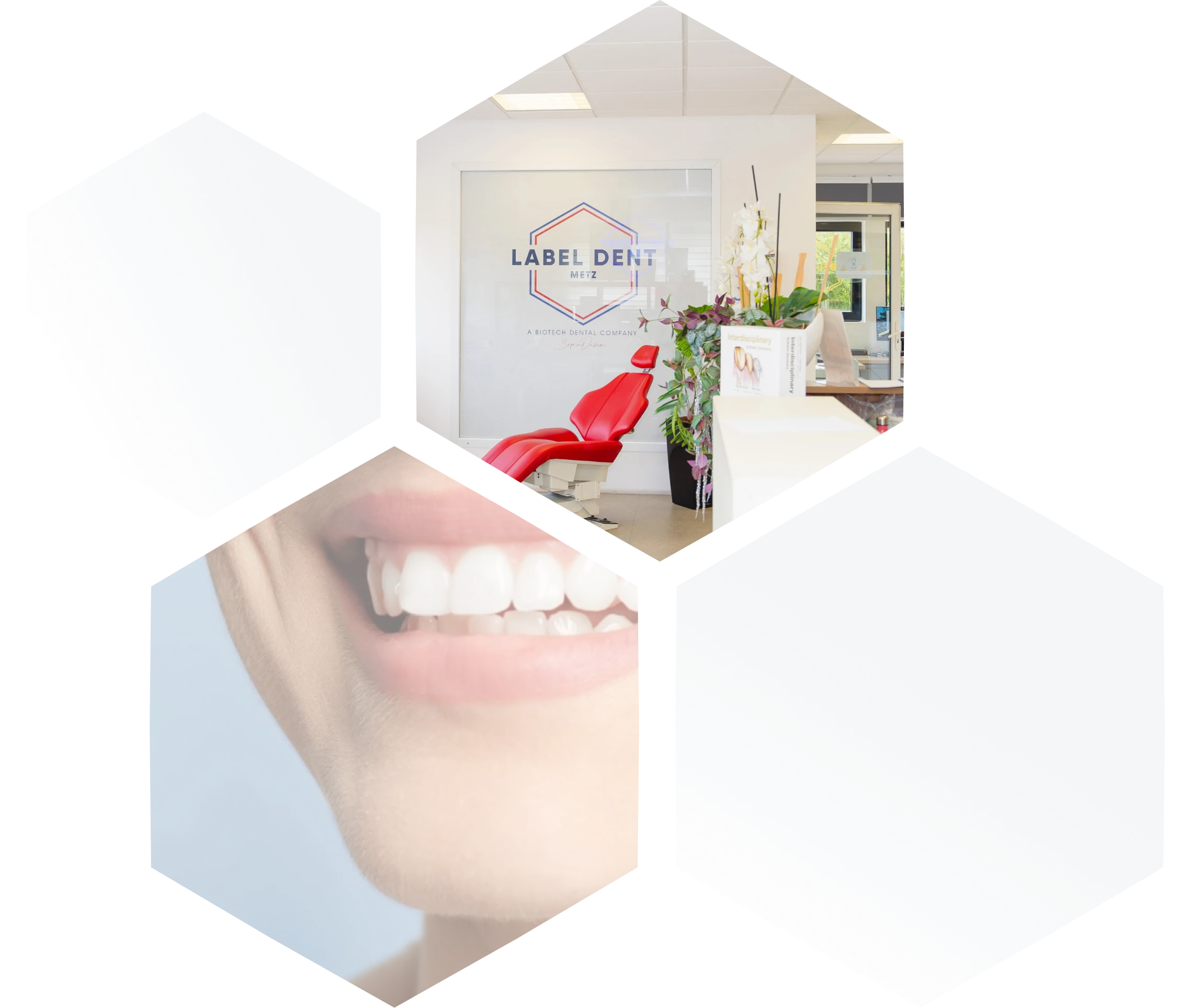 prothese numerique laboratoire dentaire precision Accueil label-dent