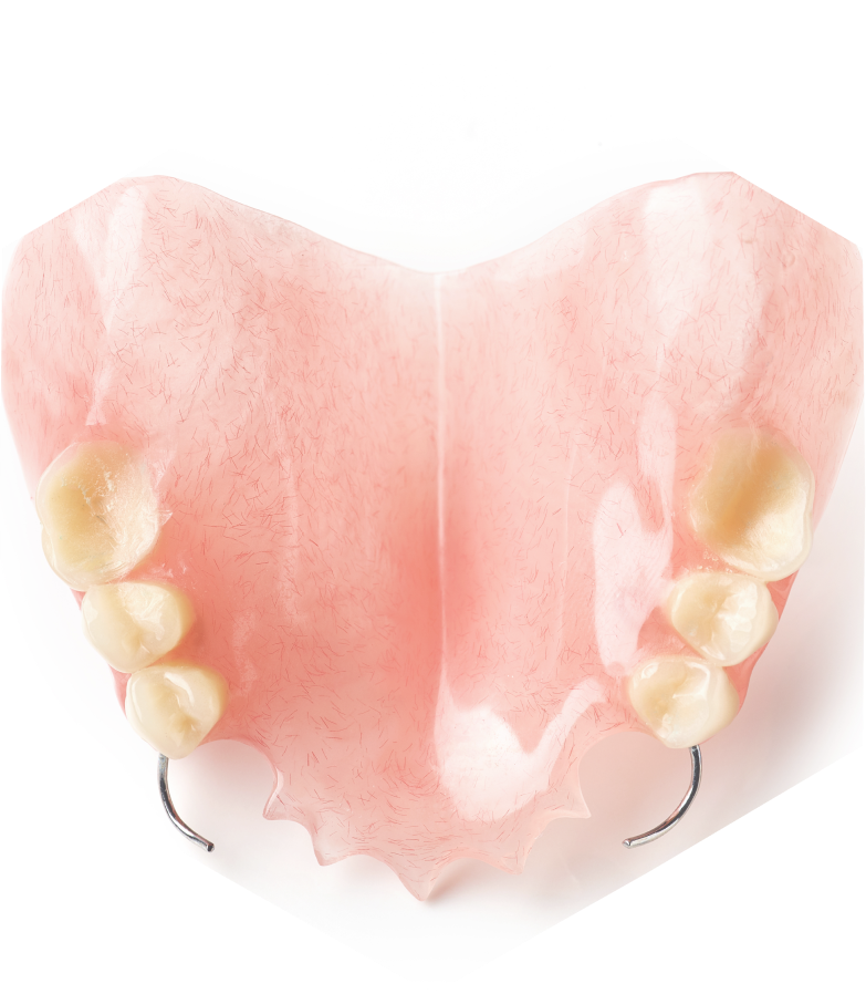 laboratoire dentaire implant dentaire marly Nos Technologies label-dent