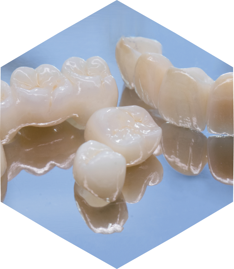 laboratoire dentaire prothese numerique marly Nos Technologies label-dent