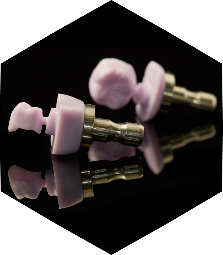 prothese adjointe numerique flux numerique moderne Nos Technologies label-dent