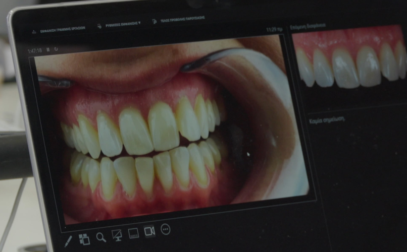 prothese dentaire technologie impression d Nondas Vlachopoulos x Sophie Dallem - FORMATION DENTAIRE label-dent